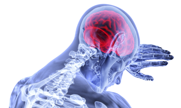 Menopause Increases Stroke Risk – Part 2