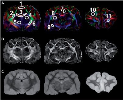 Fixing Grey and White Matter Isn’t So Black and White