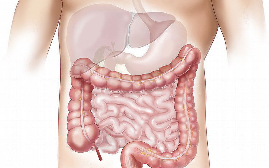 TBI Beyond the Brain: Intestinal Impact