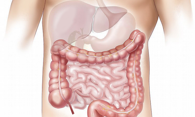 TBI Beyond the Brain: Intestinal Impact